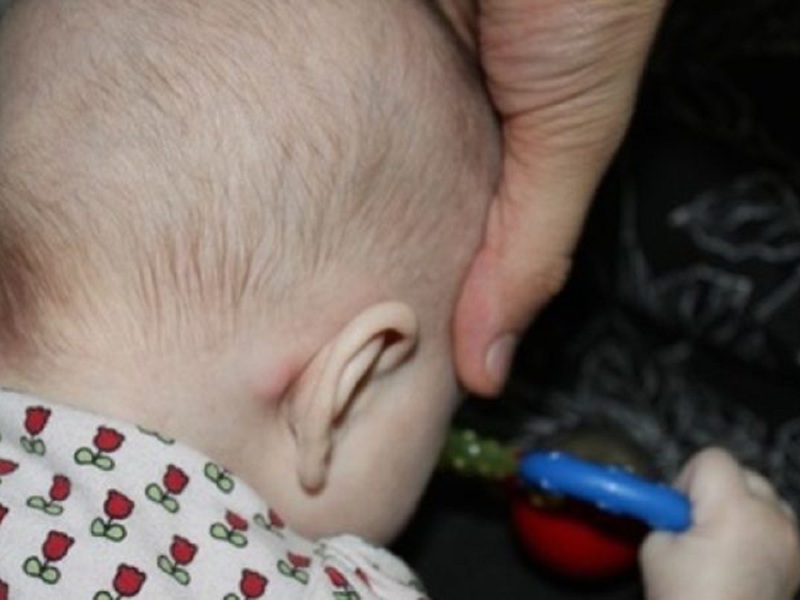 Симптомы и признаки воспаления лимфоузлов за ушами у детей