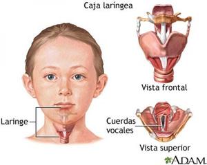 Симптомы острого стенезирующего ларинготрахеита у ребенка