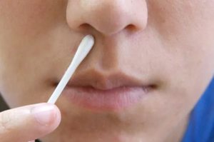 Причины возникновения болячек в носу